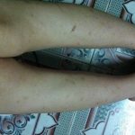 Giải đáp đúng nhất: Tắm trắng có làm mờ vết thâm không?