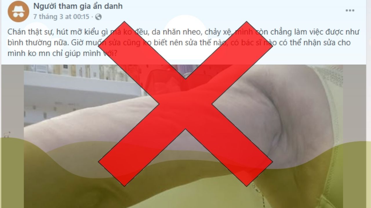 Có nên tin bài bóc phốt thẩm mỹ trên mạng? Cách kiểm chứng 2026